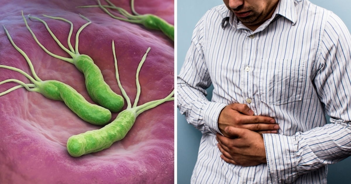 6 Sintomas De H Pylori No Estômago Com Teste Online Tua Saúde