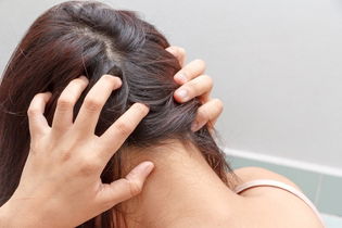 Imagen ilustrativa del artículo Hormigueo en el cuero cabelludo: 7 causas y qué hacer