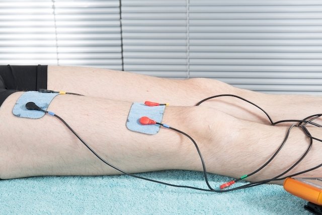 Qué es y cómo funciona la electroterapia en fisioterapia