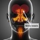 O que é sinusite, principais causas e como tratar