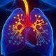 Enfisema pulmonar: o que é, sintomas, causas e tratamento
