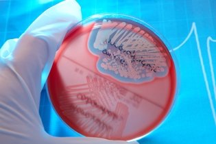 Staphylococcus saprophyticus: qué es, síntomas y tratamiento