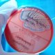 Staphylococcus saprophyticus: qué es, síntomas y tratamiento