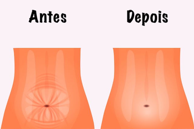 Imagem ilustrativa número 1