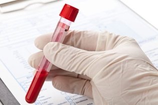 Imagen ilustrativa del artículo Examen de sangre: cuáles son y cómo interpretar los resultados