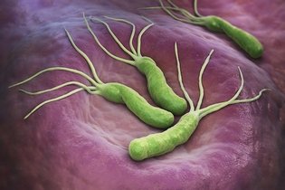 Imagen ilustrativa del artículo Helicobacter pylori: síntomas, transmisión y tratamiento
