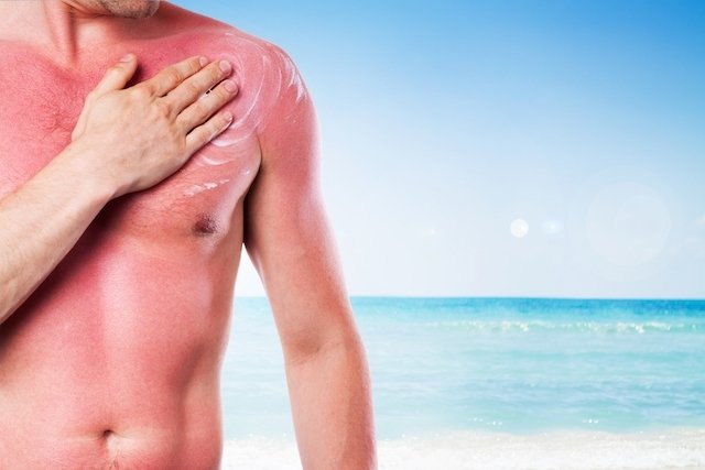 Como identificar e tratar as 6 Doenças de pele mais comuns no Verão