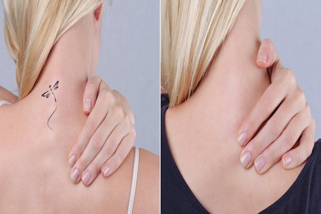 Cómo quitar un tatuaje de henna