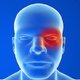 Cefaleia em salvas: o que é, sintomas, causas e tratamento