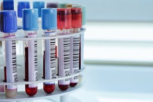 8 exames que confirmam a anemia