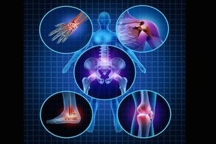 5 opções de tratamento para artrose