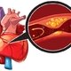 Cardiopatía isquémica: qué es, principales síntomas y tratamiento