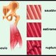 Distensão muscular: o que é, sintomas e tratamento
