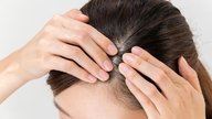 9 causas de bulto en la cabeza y qué hacer