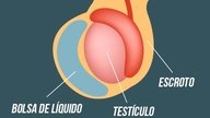 Lump on Testicle: 7 Common Causes & Treatment