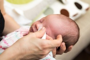 Imagem ilustrativa do artigo Como tratar o terçol em bebê
