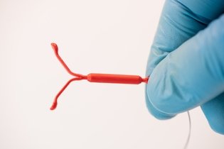 Imagem ilustrativa do artigo DIU para endometriose: 6 dúvidas mais comuns