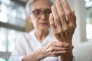 Imagem ilustrativa do artigo 6 principais sintomas de artrite reumatoide (com teste online)