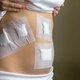 Deiscência de sutura: o que é, sintomas, causas e tratamento