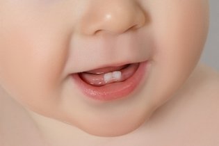 Remédios para aliviar a dor do nascimento dos dentinhos  