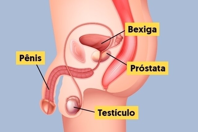 Cancer de prostata feminino