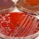 Infecção no sangue: o que é, sintomas, causas e tratamento