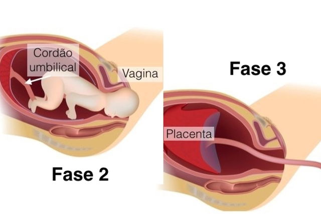 etapas y fases del trabajo de parto