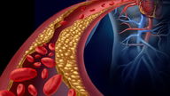Colesterol VLDL: o que é, valores e o que significa quando está alto 