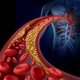 Colesterol VLDL: valores normales y qué ocurre cuando está alto o bajo