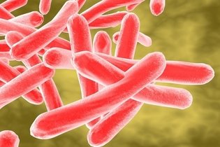 Tuberculose ganglionar: o que é, sintomas e tratamento