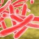 Tuberculosis Ganglionar: síntomas, contagio y tratamiento