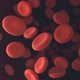 Anemia perniciosa: qué es, síntomas y tratamiento