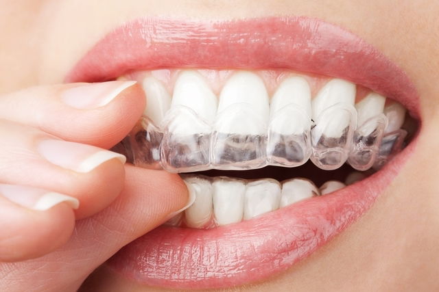 Mandíbula estalando? Fique atento com o sintoma - Blog Dentalclean