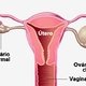 15 Ovarian Cyst Symptoms (with Online Symptoms Checker)