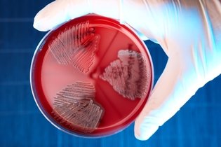 12 enfermedades causadas por bacterias: síntomas y tratamiento
