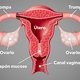 Tapón mucoso en el embarazo: cómo es y dudas comunes [imagen]