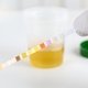 Exame de urina (EAS): para que serve, preparo e resultados