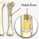 Trasplante de médula ósea: qué es, indicaciones y riesgos