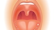 Bolitas en la lengua: 7 causas y qué hacer 