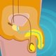 Ejaculação retrógrada: o que é, sintomas e tratamento