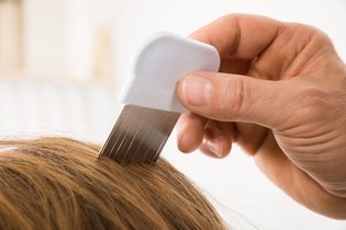 Imagem ilustrativa do artigo Como usar o shampoo para piolho