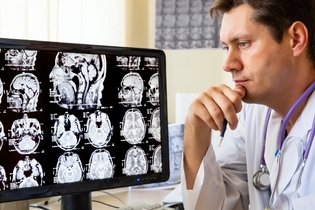  Neurosífilis: qué es, síntomas y tratamiento