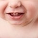 O que causa gengiva inchada no bebê (e o que fazer)