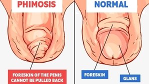 Penis frenulum Problems with