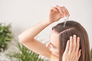 Imagem ilustrativa do artigo  Minoxidil para cabelo: como funciona e como usar