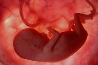 Imagem ilustrativa do artigo Sofrimento fetal: o que é, sintomas (e o que fazer)