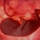 Sofrimento fetal: o que é, sintomas (e o que fazer)