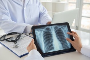 Imagem ilustrativa do artigo Pneumonia bilateral: o que é, sintomas, causas e tratamento