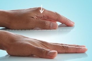 Imagen ilustrativa del artículo 7 ejercicios para dedo en gatillo (con imágenes)