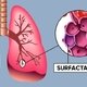 Surfactante pulmonar: qué es, funciones y falta de surfactante
